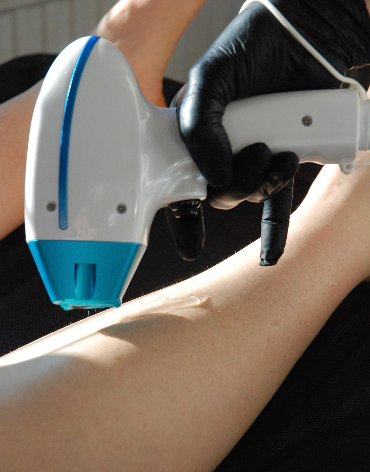 IPL Haarentfernung Behandlung